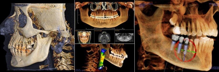 Cone Beam Scanner or Patient